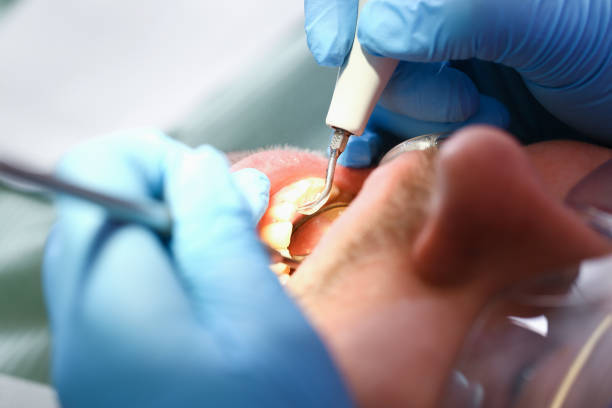  Ben Wheeler, TX Emergency Dentist Pros