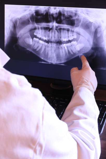 Best Emergency Treatment for Dental Infections or Abscesses in Ben Wheeler, TX