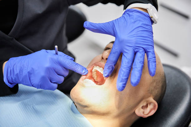 Best Emergency Gum Treatment in Ben Wheeler, TX